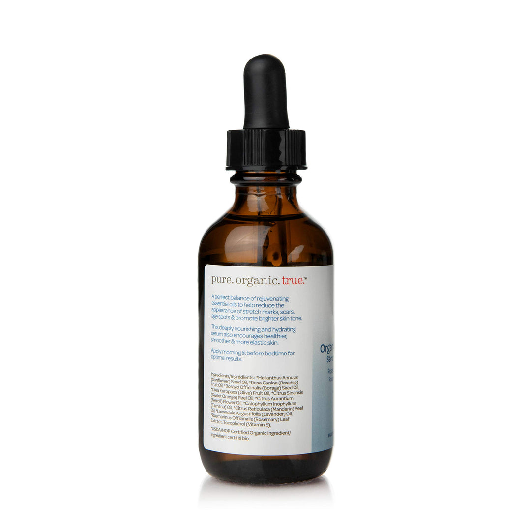 Shoosha - Stretch Mark Serum - Image 9